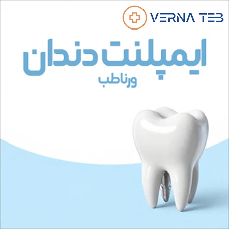 ایمپلنت دندان چیست؟ مزایا و هزینه