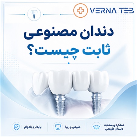 دندان مصنوعی ثابت چیست ؟