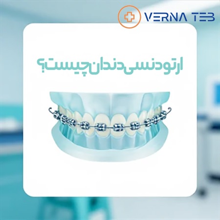 ارتودنسی دندان چیست؟ مزایا و هزینه